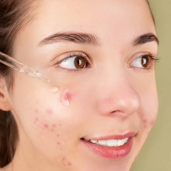 Woman applying facial serum with a glass dropper